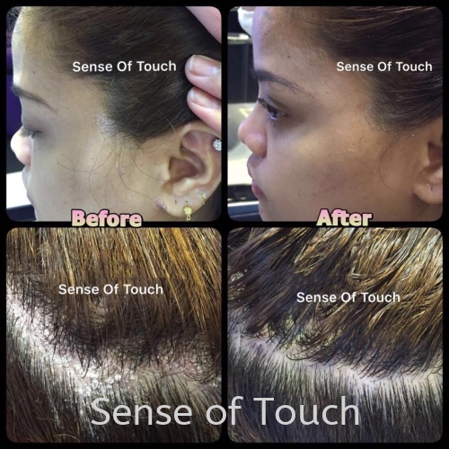 Sense of Touch Scalp Treatment Testimony / 头皮护理 & 敏感头皮 & 头皮屑