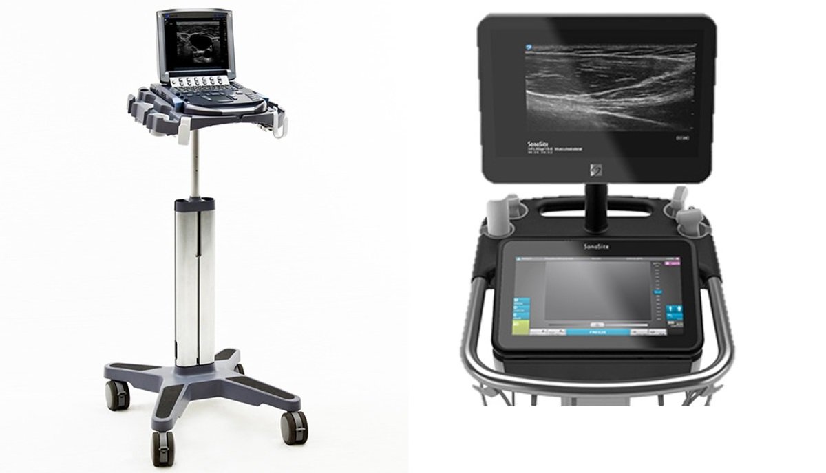 Fujifilm SonoSite Wants to Bring AI to Ultrasound