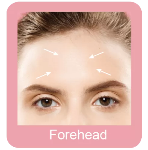 Permanent hair removal forehead