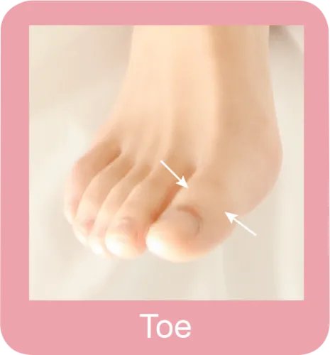 Permanent hair removal toes