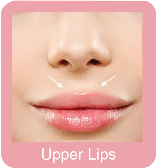 Hair Removal of Lips