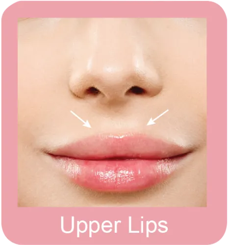 Permanent hair removal upper lips