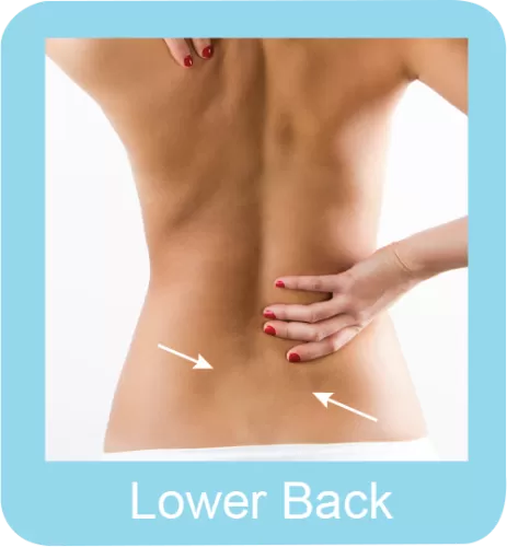 Permanent hair removal lower back