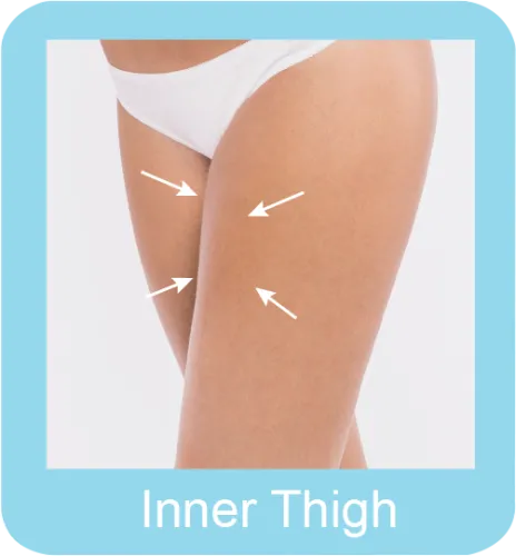 Permanent hair removal  thigh