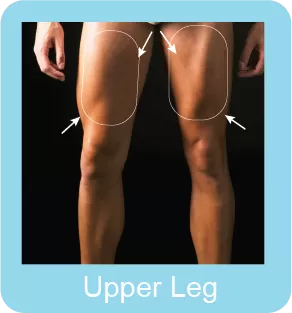 Upper Leg