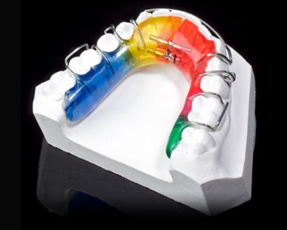 SHERAKFO-GIPS ORTHODONTICS STONE (SUPER WHITE), TYPE III, SHERA