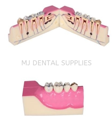 MOLAR CROSS STUDY MODEL, #M4009