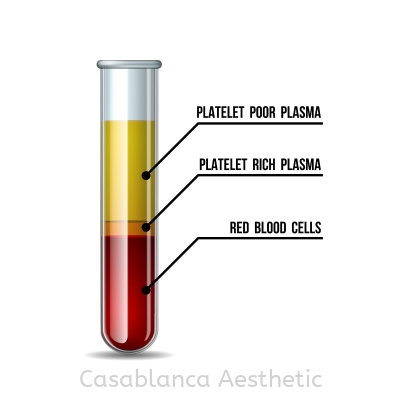 Platelet Rich Plasma (PRP) Facial