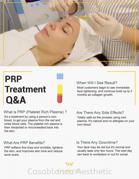 PRP Facial Q&A PRP Treatment  Kuala Lumpur (KL), Malaysia, Selangor, Ampang, Petaling Jaya (PJ) Services | CASABLANCA AESTHETIC