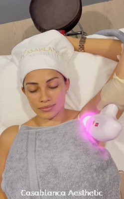 Diode Laser Hair Removal