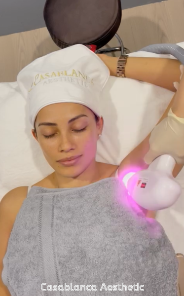 Diode Laser Hair Removal ë   Services | CASABLANCA AESTHETIC