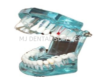 IMPLANT MODEL WITH RESTORATION INLAY, ONLAY, BRIDGE, PATHOLOGIES, IMPACTION #M2001 Implant Series Tooth Model Dentistry Material Selangor, Malaysia, Kuala Lumpur (KL), Shah Alam Supplier, Distributor, Supply, Supplies | MJ Dental Supplies