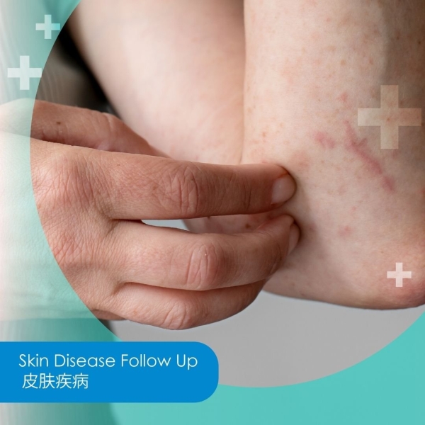 Skin Disease Follow Up Skin Disease Follow Up Malaysia, Kuala Lumpur (KL), Selangor, Kepong, Cheras, Puchong Clinic | Klinik Medilove