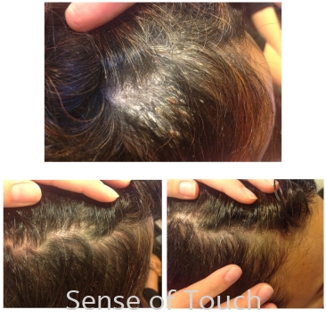 Sensitive Scalp Treatment / 头皮敏感