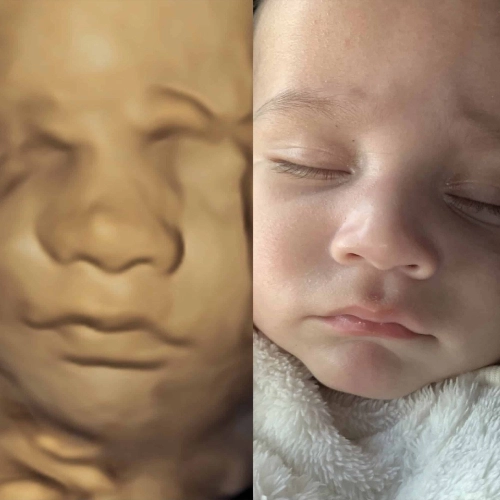 3D / 4D / 5D / 6D Ultrasound Scan