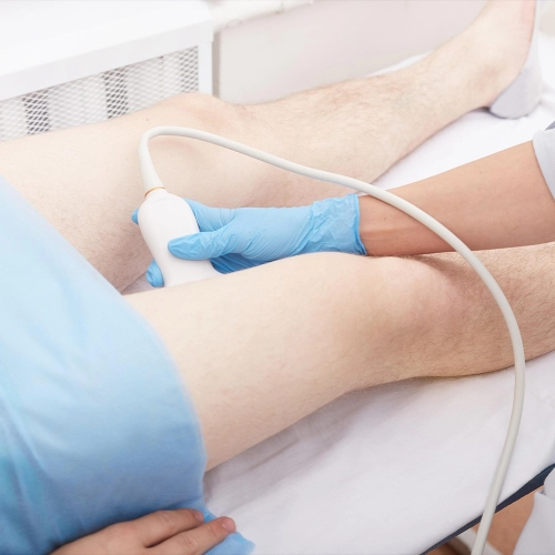 DVT Scan-varicose Scan Lower Extremities Vein Study