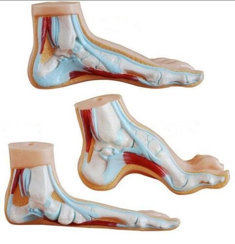 V.25 NORMAL, FLAT AND ARCHED FOOT 㡢ƽ㡢ģ V. Models ģ Selangor, Malaysia, Kuala Lumpur (KL), Petaling Jaya (PJ) Supplier, Suppliers, Supply, Supplies | San-Tronic Medical Devices Sdn Bhd