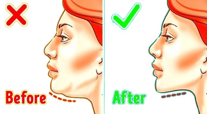 Face : Double Chin 10ml