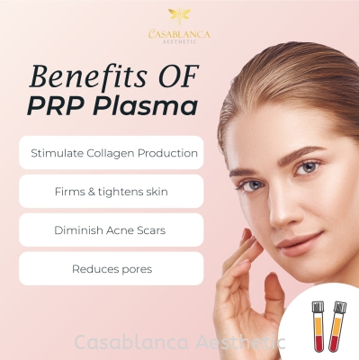 PRP treatment