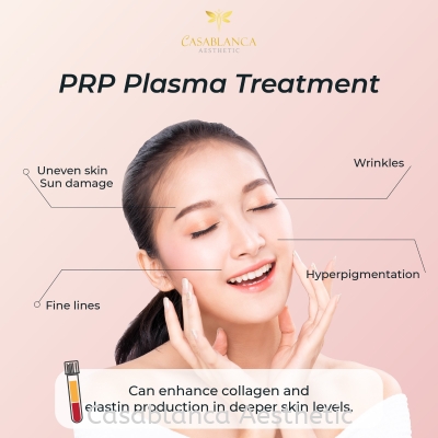 PRP treatment 