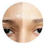 Uneven Skin Tone / Dull Skin