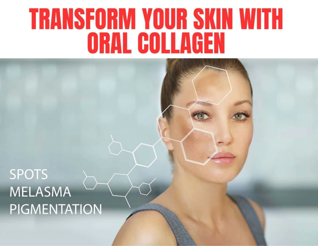Singapore's Glow Revolution: Transform Your Skin with Oral Collagen and Say Goodbye to Hyperpigmentation/Dark Spot