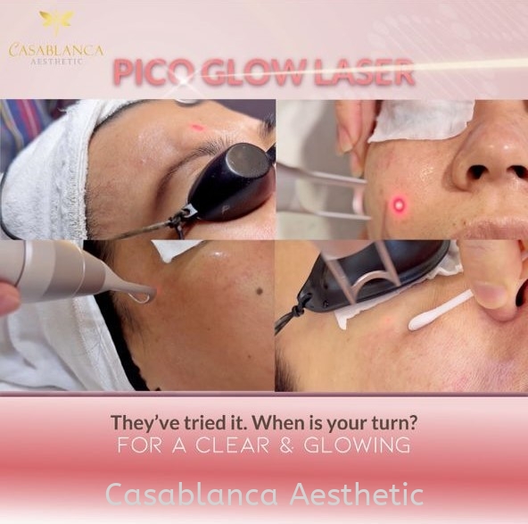 Pico Laser pico laser Kuala Lumpur (KL), Malaysia, Selangor, Ampang, Petaling Jaya (PJ) Services | CASABLANCA AESTHETIC