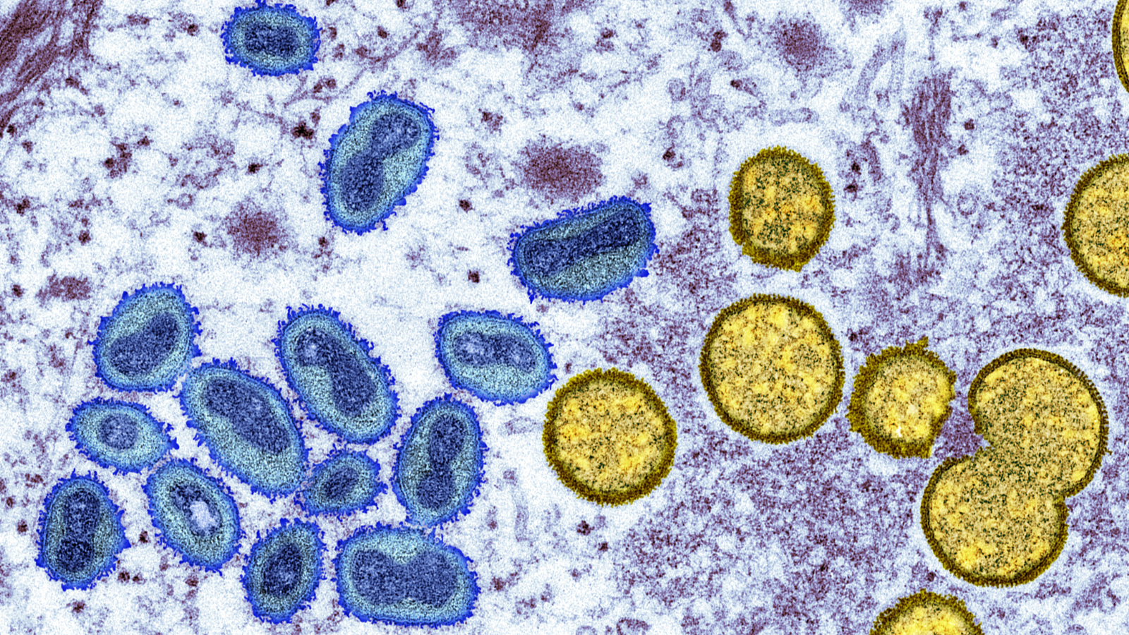 Mpox outbreak declared a "continental emergency" in DRC, killing 570