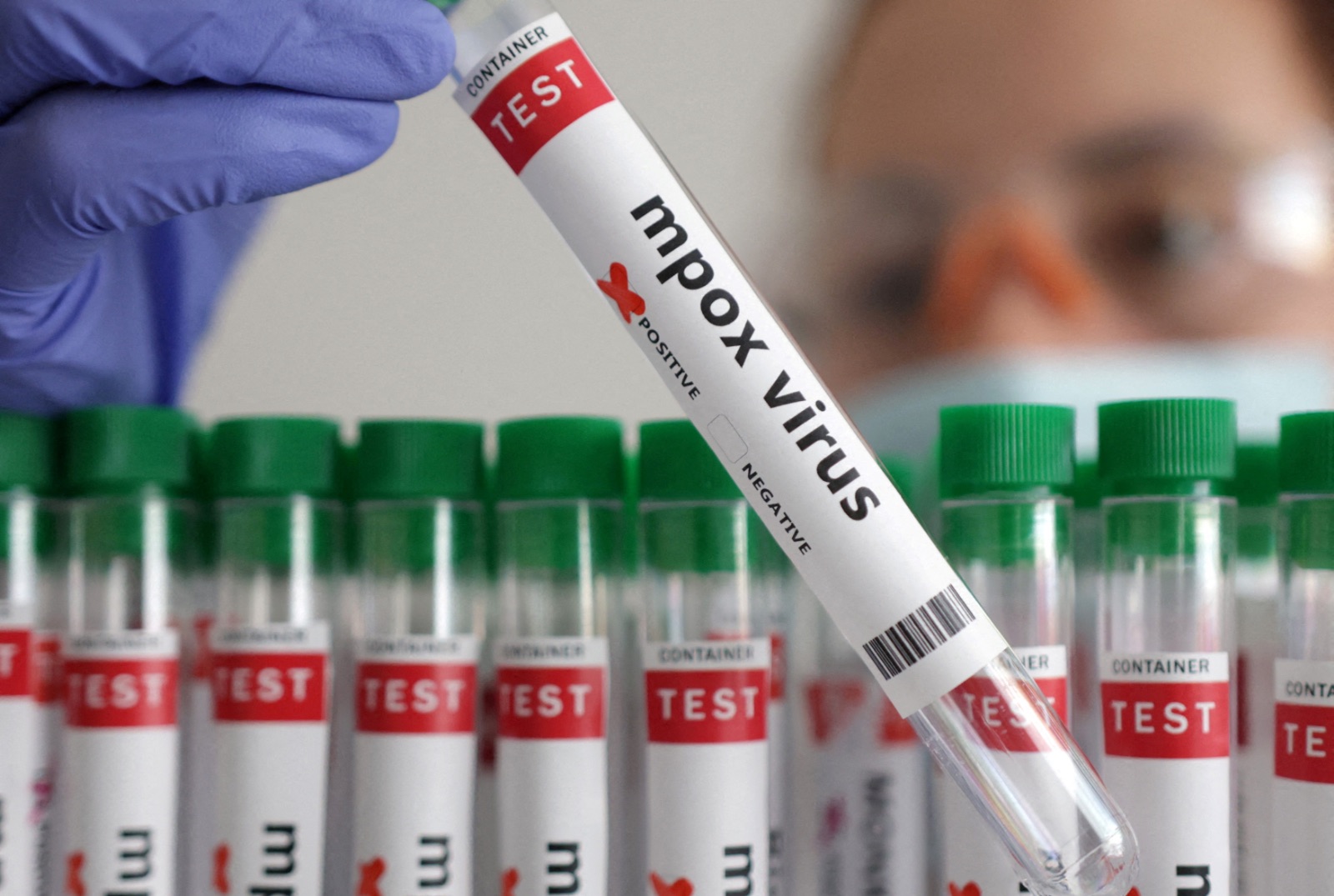 Morocco reports first Mpox case