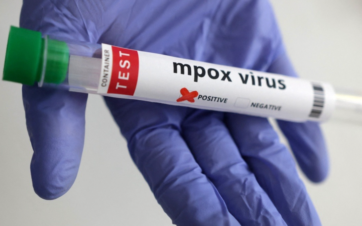 First case of new Mpox variant confirmed in Germany