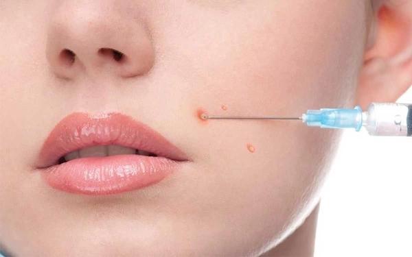Acne Injection