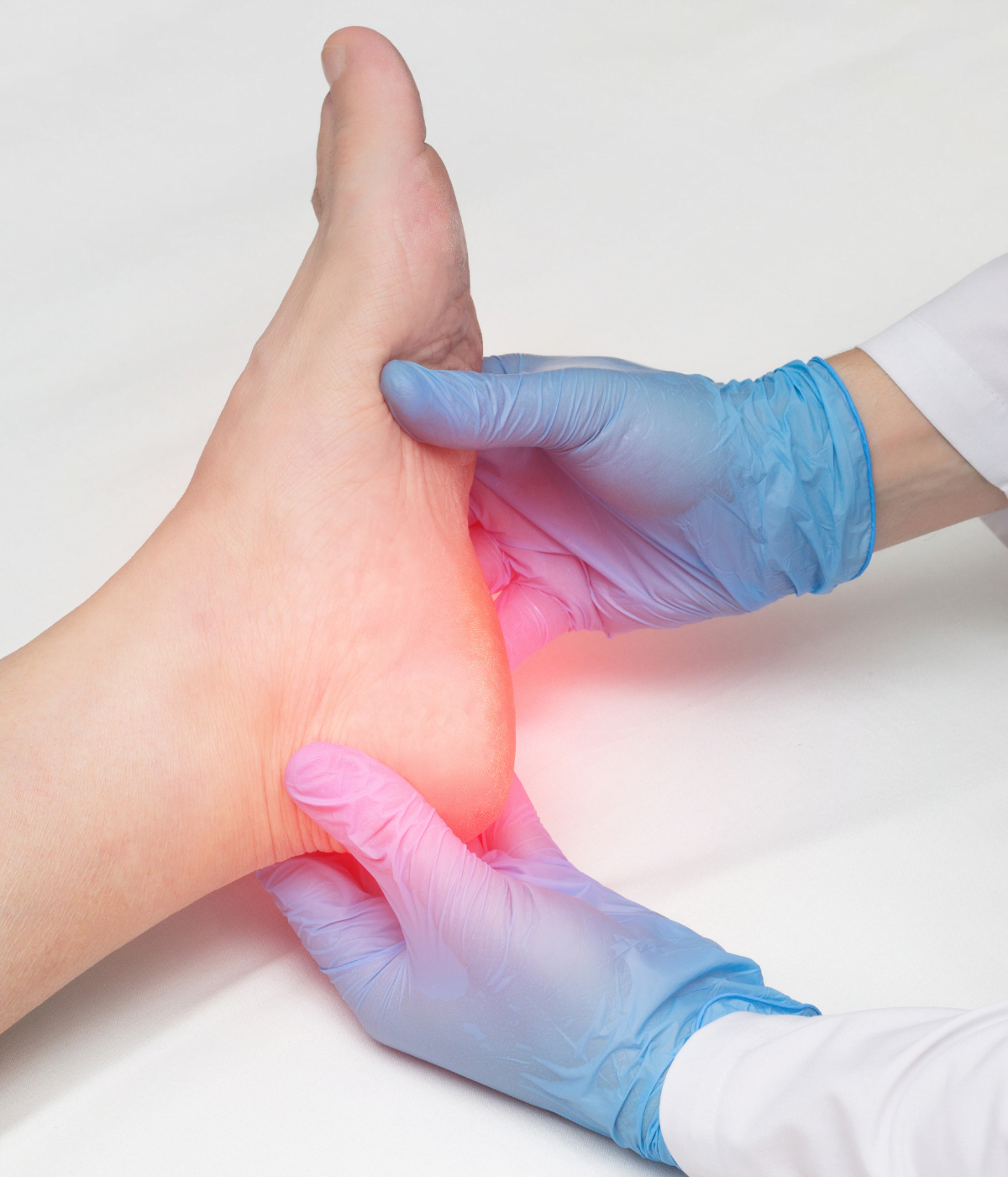 Plantar Fasciitis