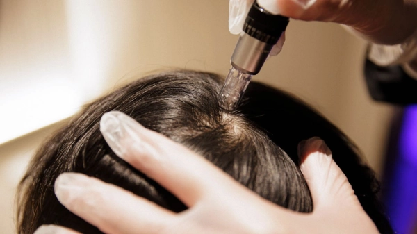 Hair Stem Cell Rejuvenation