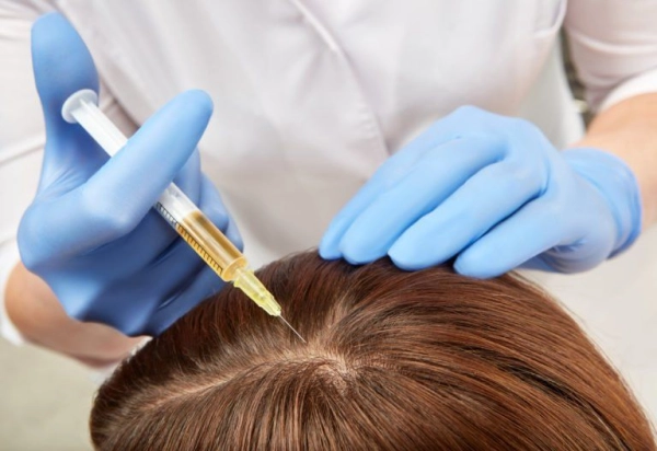 PRP (Hairline / Hair Treatment)