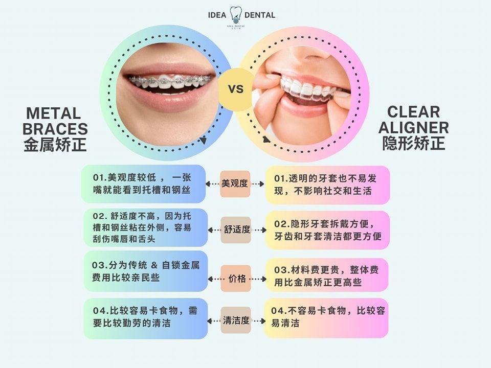 Invisible Braces vs Metal Braces in Johor Bahru (JB)