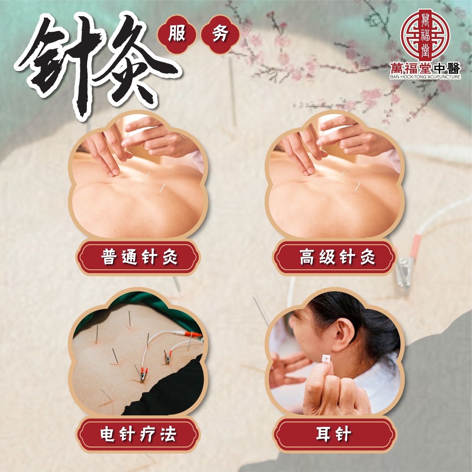 寻找新山最好的针灸治疗