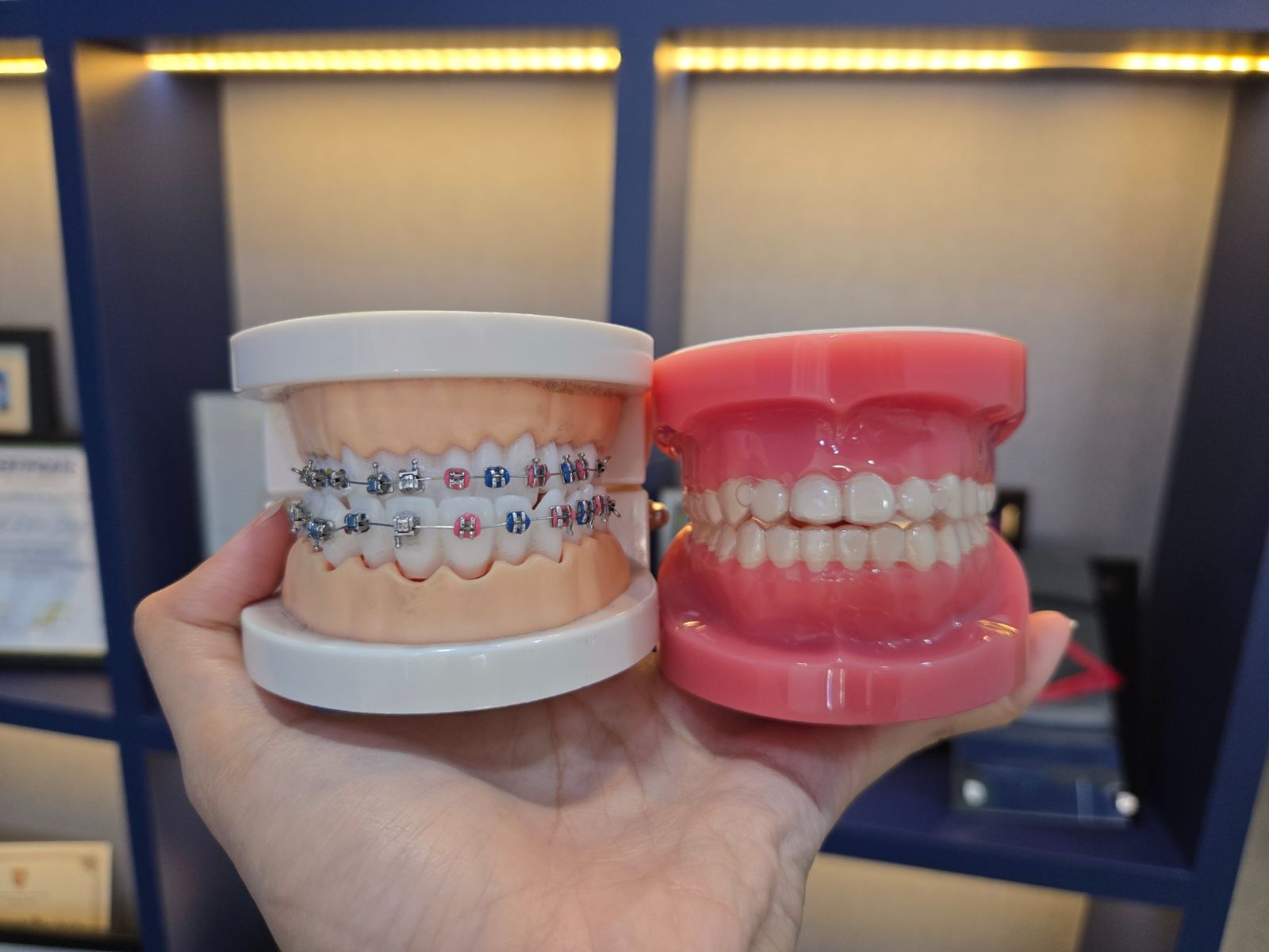 Clear Aligners vs Braces: Which is Better in Johor Bahru?