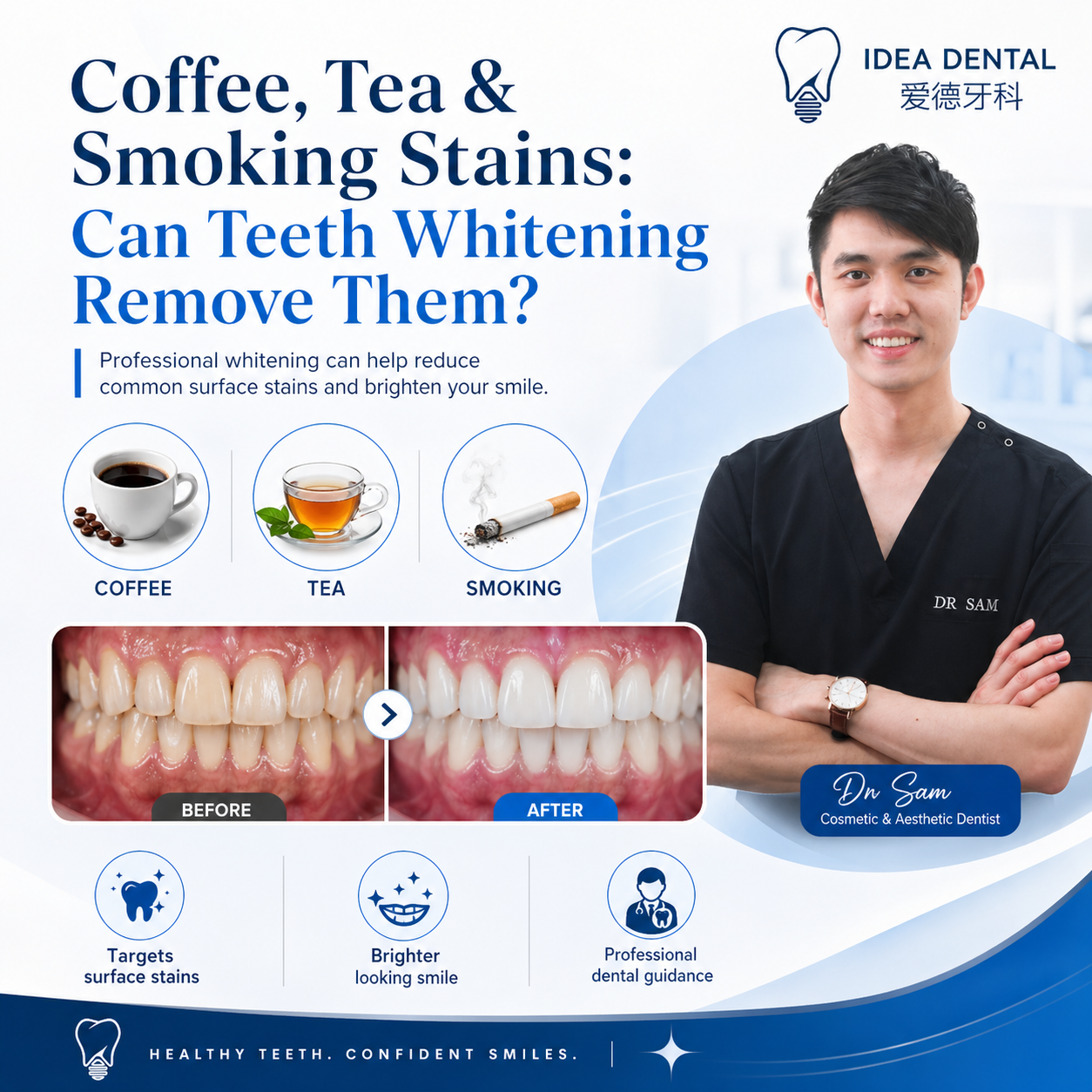 Coffee, Tea & Smoking Stains: Can Teeth Whitening Remove Them?