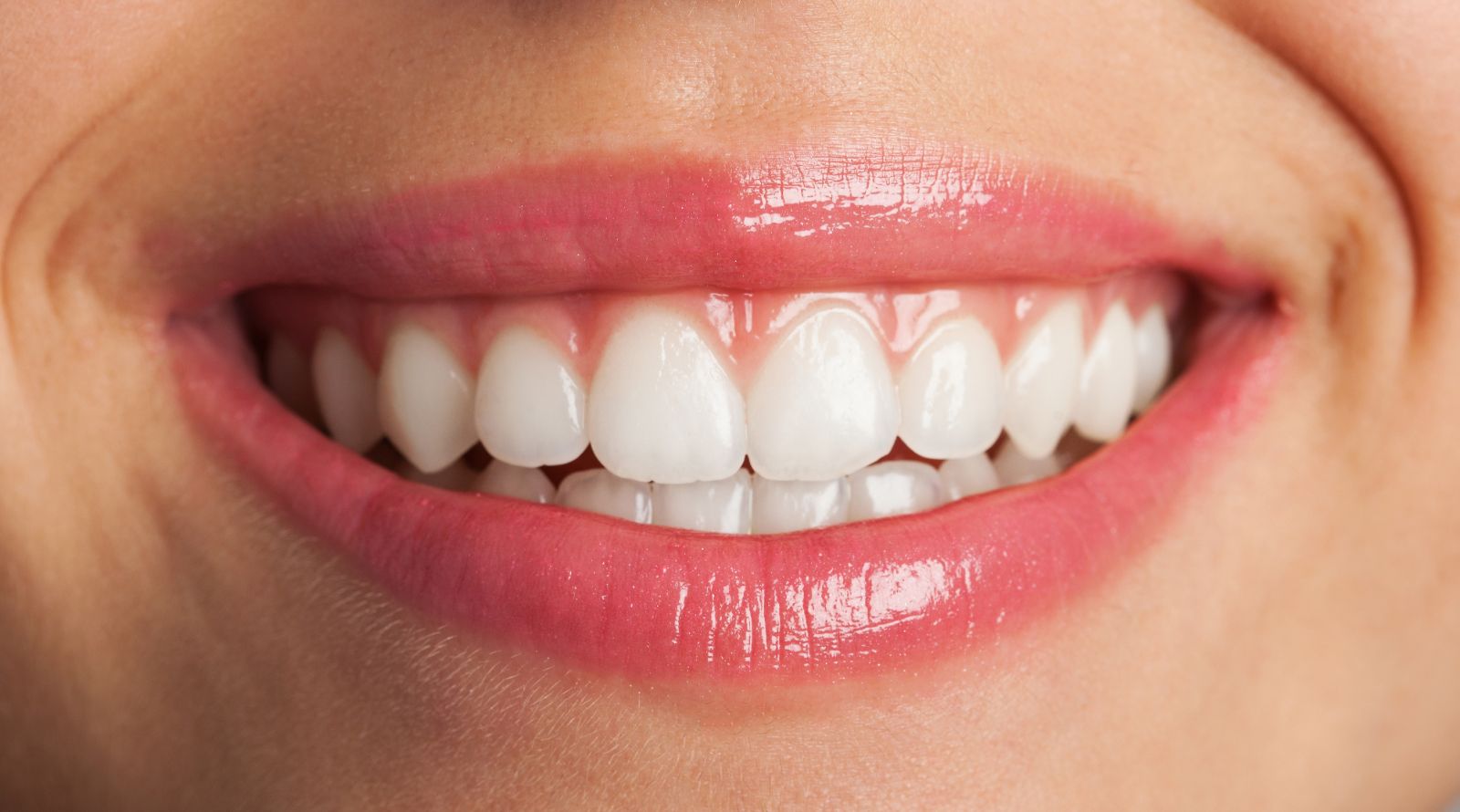 Professional Teeth Whitening in JB That Looks Natural