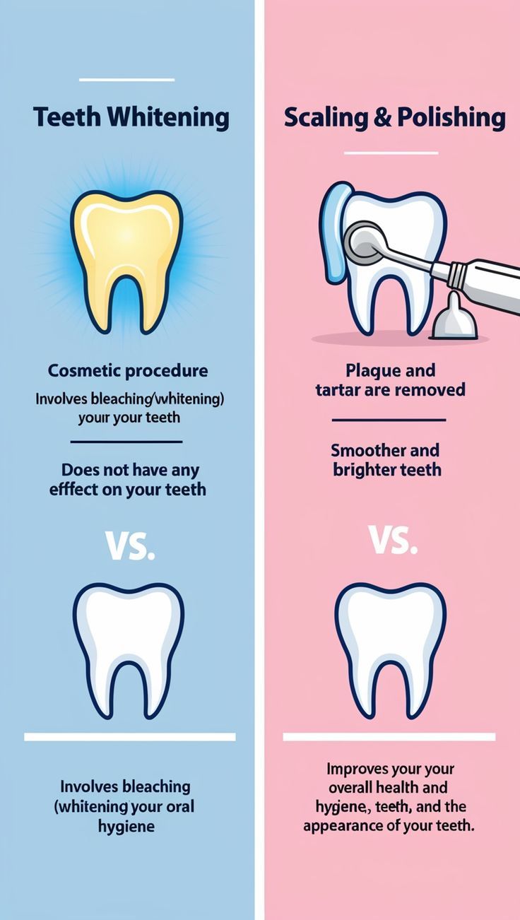 Scaling vs Teeth Whitening: What’s the Difference