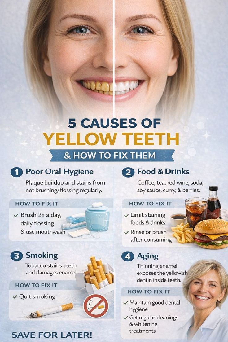Why Do Teeth Become Yellow Even After Brushing? (Johor Bahru Guide 2026)