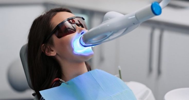 Can Teeth Whitening Damage Your Teeth? What JB Dentists Say (2026 Guide)