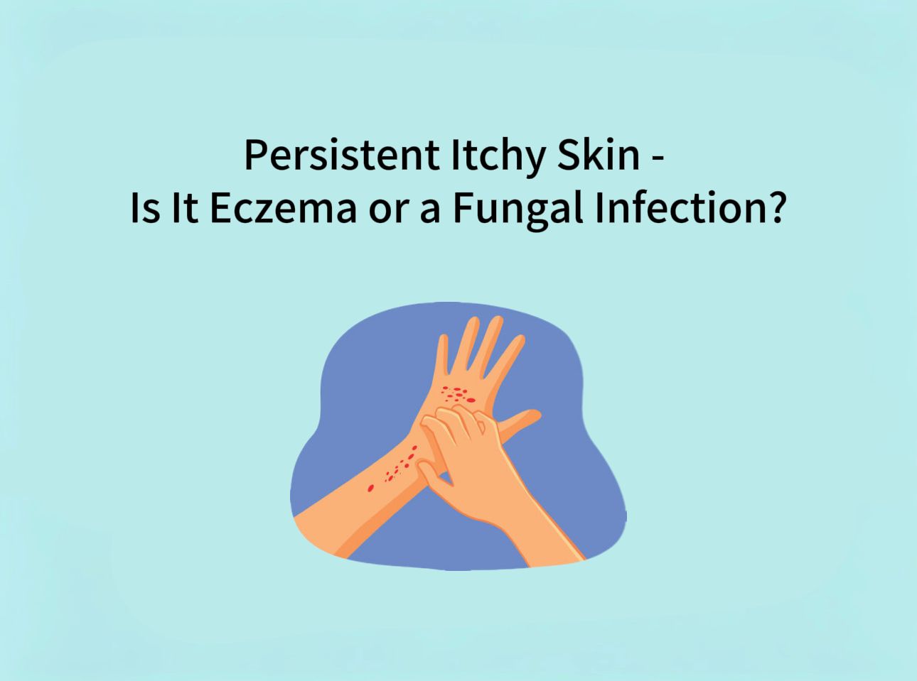 Persistent Itchy Skin — Is It Eczema or a Fungal Infection?