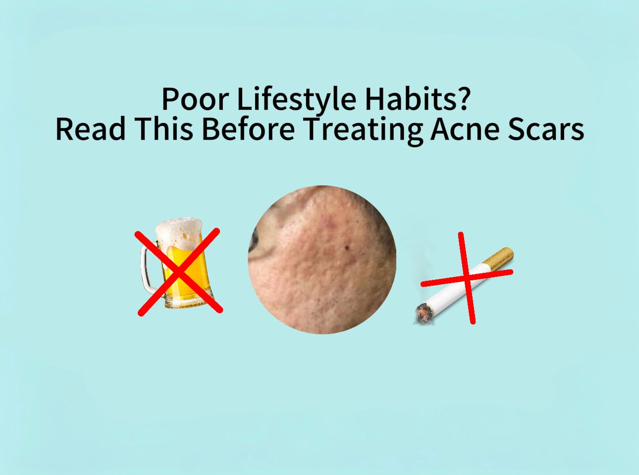 Why Do Some People See Poor Results After Acne Scar Treatment?