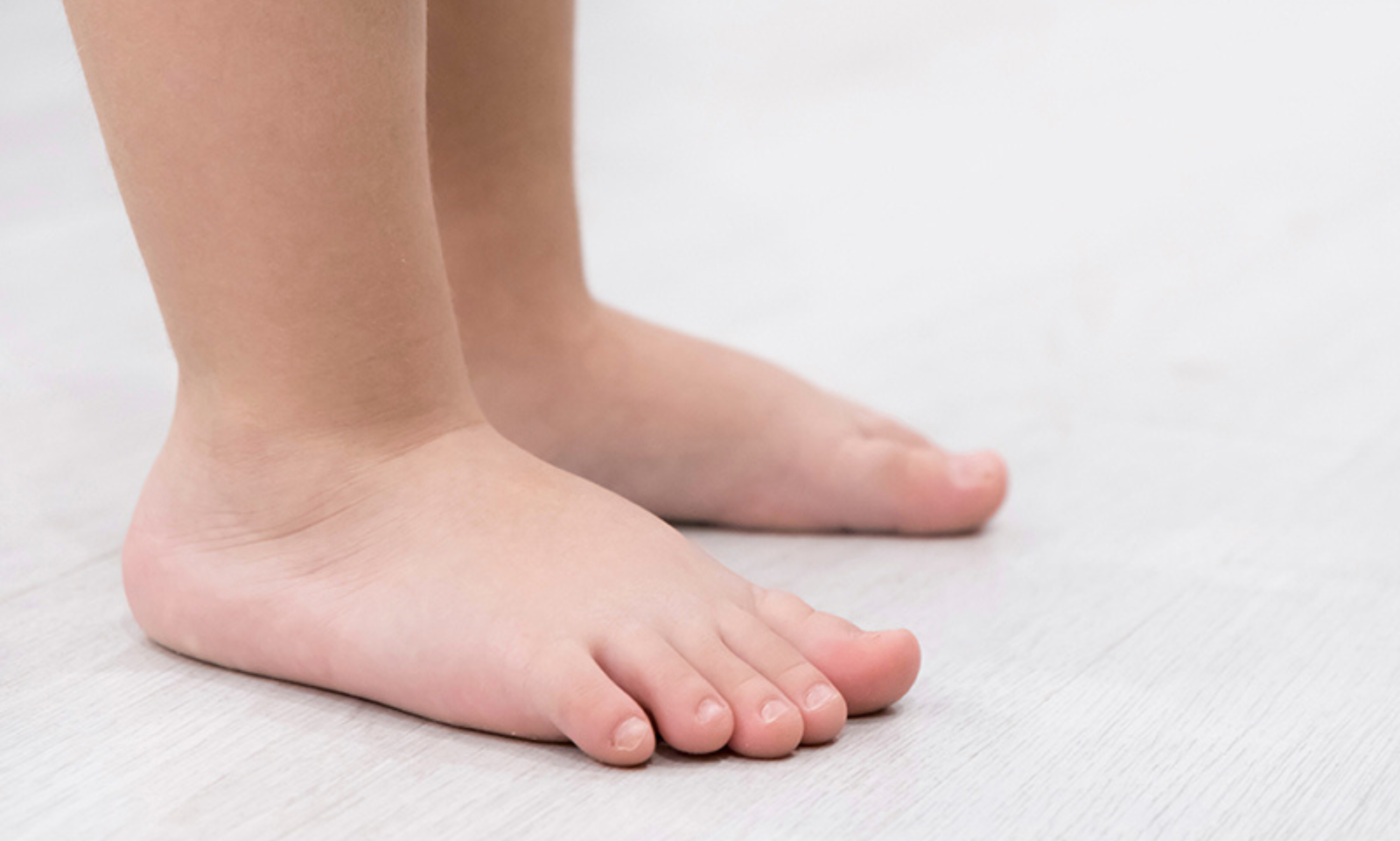 Can Flat Feet Cause Back Pain? Understanding the Connection Between Foot Health and Skeletal Alignment