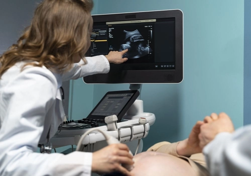 Ultrasound Kehamilan