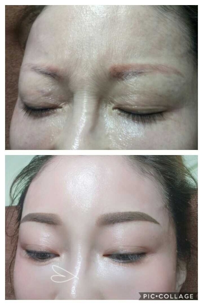 eyebrow reborn treatment üë