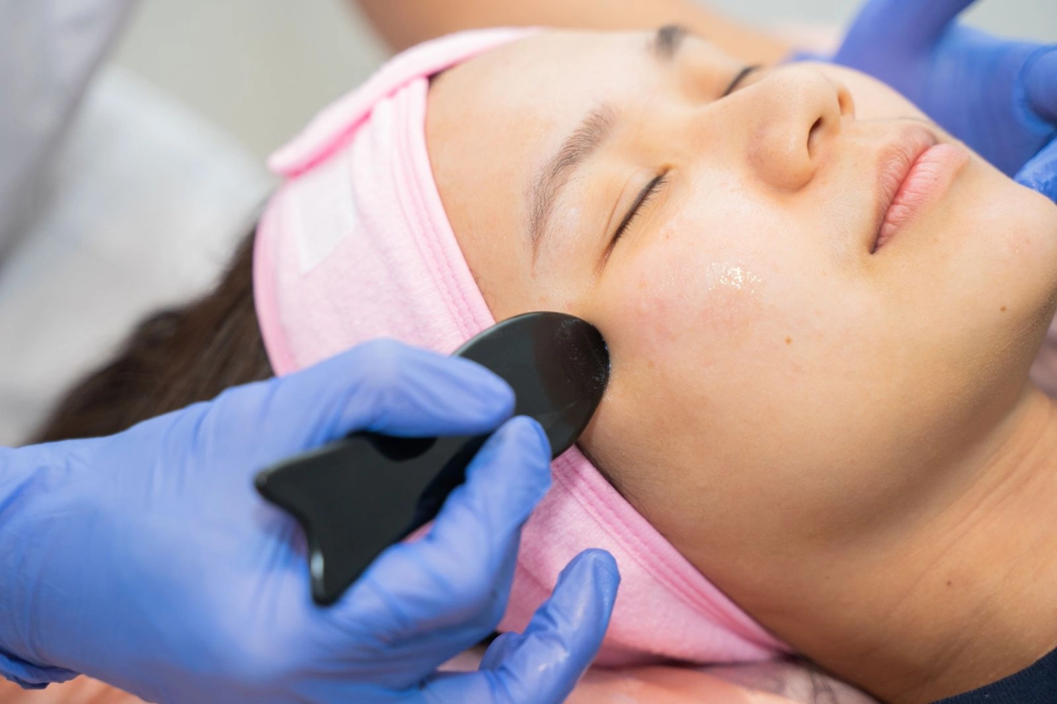 FACIAL REJUVENATION ACUPUNCTURE+FACIAL GUA SHA(Buy 10 free 3)