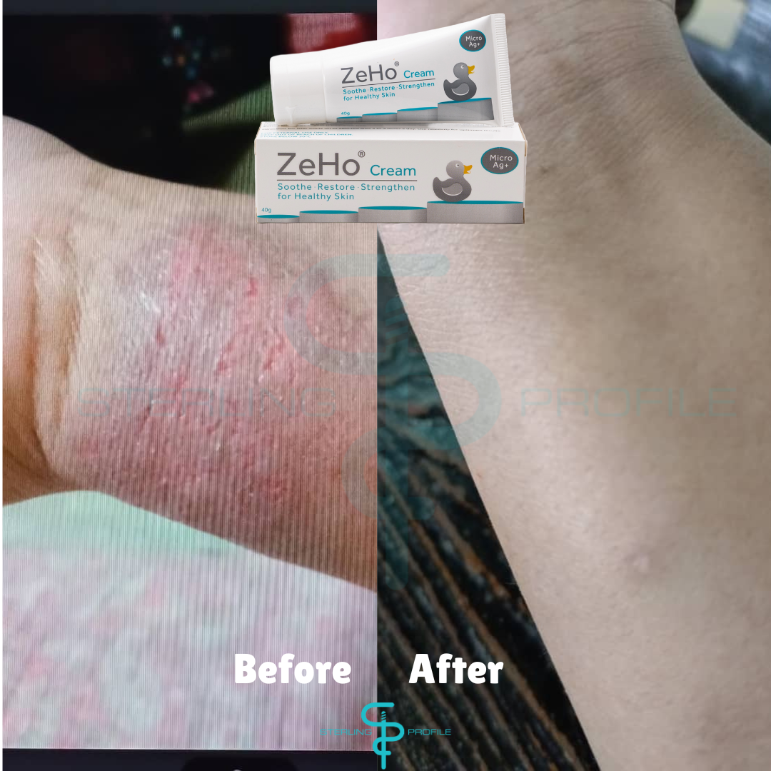 ZeHo MicroAg+ Cream Testimonial  & Sterling Profile Sdn Bhd