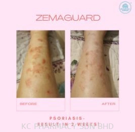 (HOT PRODUCT) DERMA HEALTH Zemaguard 50ml (Skin Relief, Rehydrating & Repair Serum)